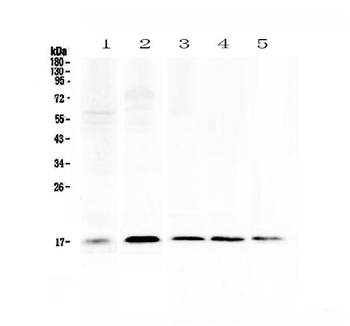 Psoriasin/S100A7 Rabbit Polyclonal Antibody