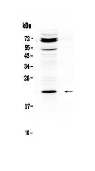 C19orf80/ANGPTL8 Rabbit Polyclonal Antibody