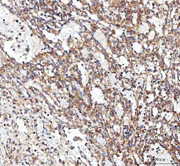 VE-Cadherin CDH5-/VE Rabbit Polyclonal Antibody