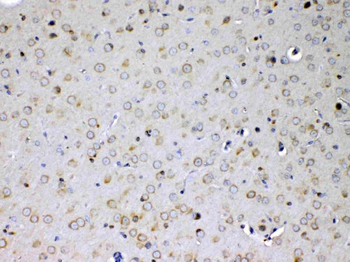 IL15RA Antibody
