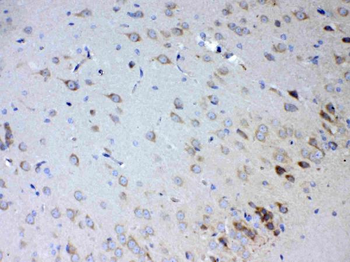 IL15RA Antibody