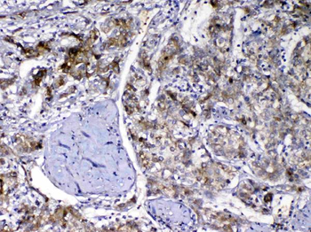 Vitamin D Binding protein/GC Antibody