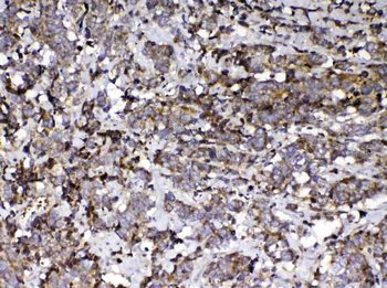 Vitamin D Binding protein/GC Antibody