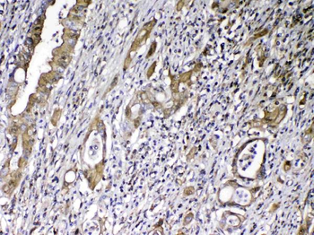 Vitamin D Binding protein/GC Antibody