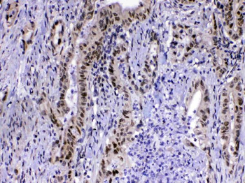 MED15 Antibody