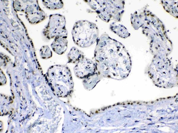 MED15 Antibody