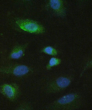 MMP10 Rabbit Polyclonal Antibody