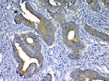 MMP10 Rabbit Polyclonal Antibody