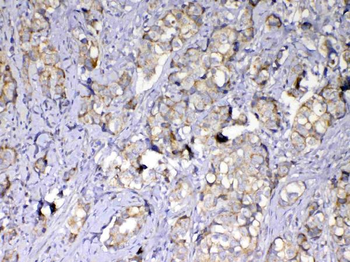 MMP10 Rabbit Polyclonal Antibody