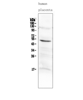 MMP10 Rabbit Polyclonal Antibody