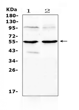 MMP10 Rabbit Polyclonal Antibody
