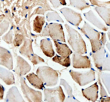 Myoglobin/MB Rabbit Polyclonal Antibody