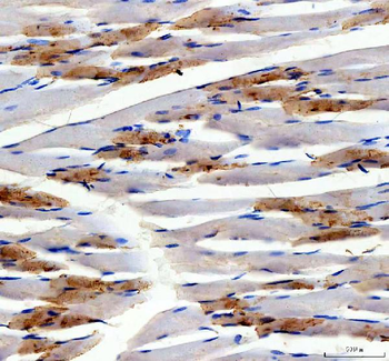 Myoglobin/MB Rabbit Polyclonal Antibody