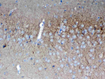 SAP102/DLG3 Rabbit Polyclonal Antibody