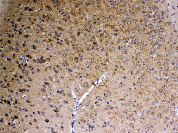 SAP102/DLG3 Rabbit Polyclonal Antibody