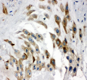Noggin Rabbit Polyclonal Antibody