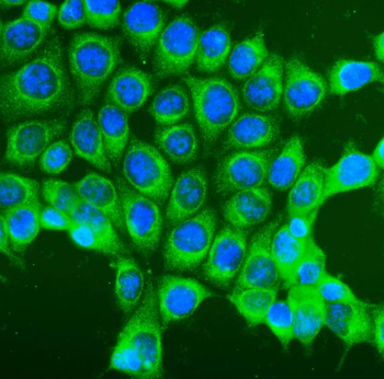 COPE Rabbit Polyclonal Antibody
