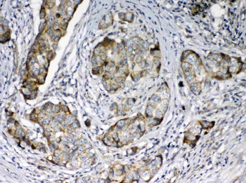 FZD3 Rabbit Polyclonal Antibody