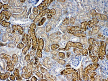 FZD3 Rabbit Polyclonal Antibody