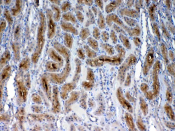 FZD3 Rabbit Polyclonal Antibody