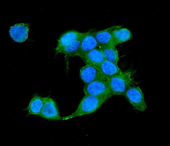 IQGAP2 Rabbit Polyclonal Antibody
