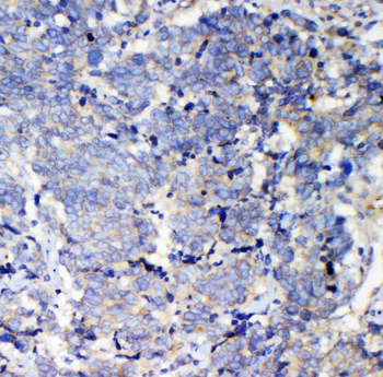 IQGAP2 Rabbit Polyclonal Antibody
