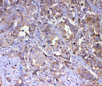 IQGAP2 Rabbit Polyclonal Antibody
