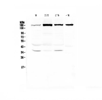 IQGAP2 Rabbit Polyclonal Antibody