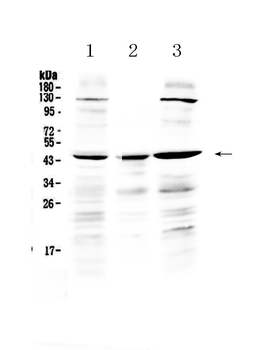 PREB Rabbit Polyclonal Antibody