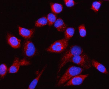 CP110/CCP110 Rabbit Polyclonal Antibody