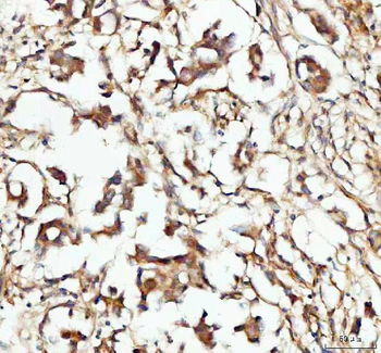 CP110/CCP110 Rabbit Polyclonal Antibody
