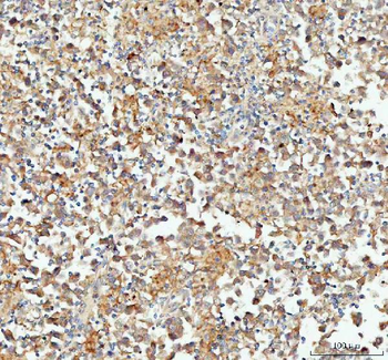 CP110/CCP110 Rabbit Polyclonal Antibody