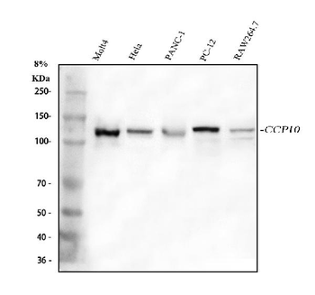 CP110/CCP110 Rabbit Polyclonal Antibody