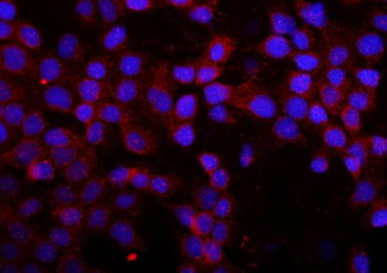 MMP16 Rabbit Polyclonal Antibody