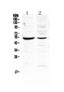 MMP16 Rabbit Polyclonal Antibody