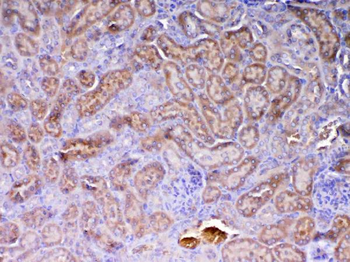 AMD1 Rabbit Polyclonal Antibody