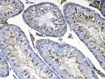 FMN1 Rabbit Polyclonal Antibody