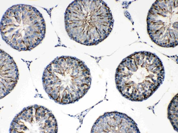 FMN1 Rabbit Polyclonal Antibody