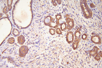 Hsp20/HSPB6 Antibody