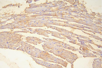 Hsp20/HSPB6 Antibody
