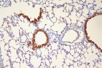 Hsp20/HSPB6 Antibody