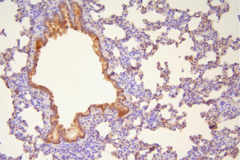 Hsp20/HSPB6 Antibody