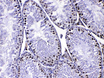 MED8 Rabbit Polyclonal Antibody