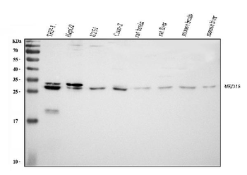 MED8 Rabbit Polyclonal Antibody
