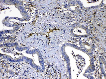 HOMER3 Rabbit Polyclonal Antibody