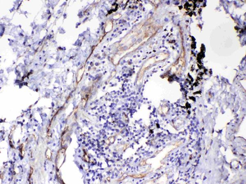 HOMER3 Rabbit Polyclonal Antibody
