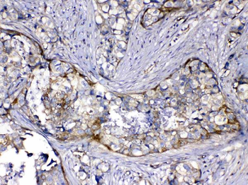 HOMER3 Rabbit Polyclonal Antibody