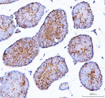 Epigen/Epgn Rabbit Polyclonal Antibody