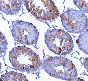 Epigen/Epgn Rabbit Polyclonal Antibody
