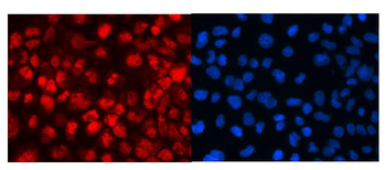 MED18 Antibody